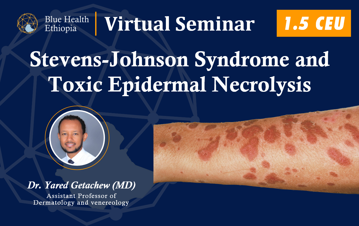 Stevens-Johnson syndrome and toxic
